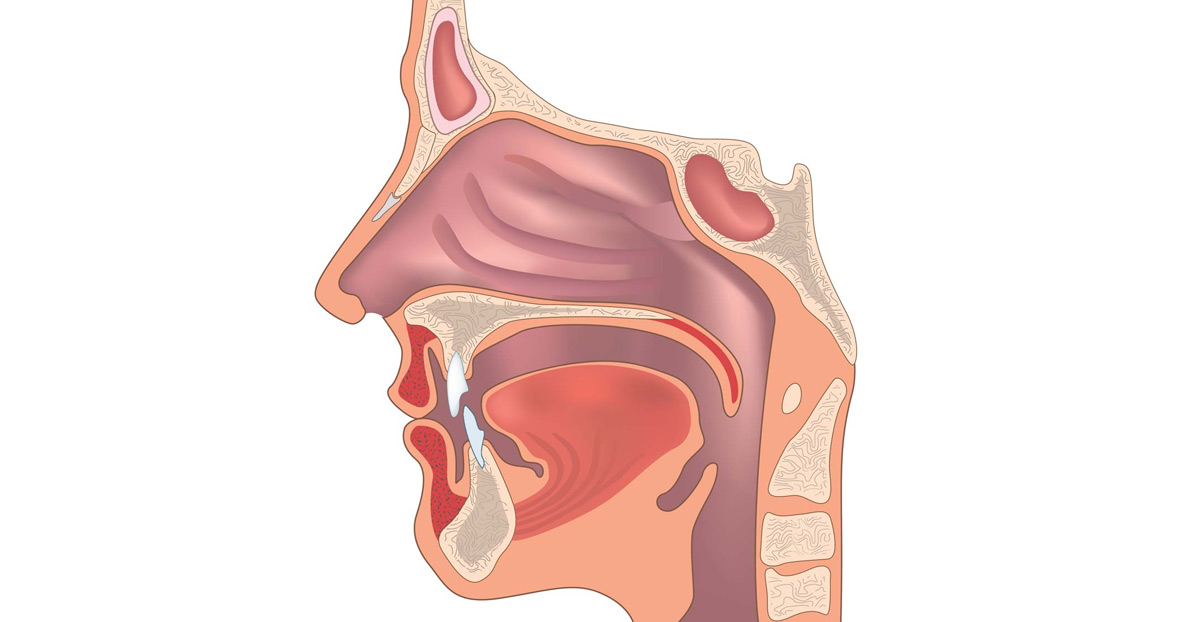 Image-Guided-Sinus-Surgery-Dr.-Naveen-Bhandarkar